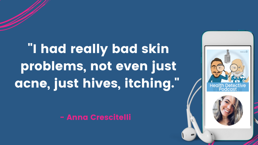 ACNE, HIVES, ITCH, The Health Detective Podcast, Anna Crescitelli